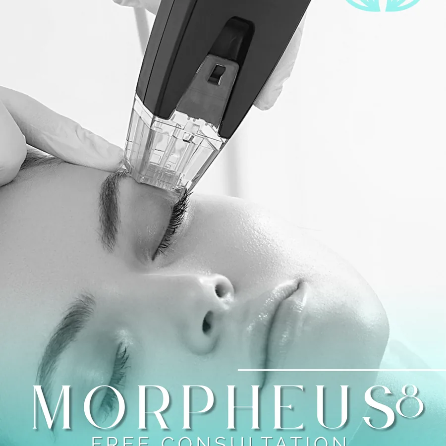 Morpheus 8 facial remodeling